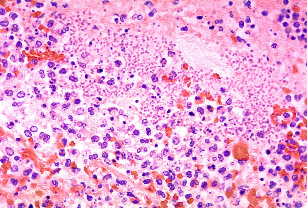 Yersinia pestis по Романовскому-Гимзе