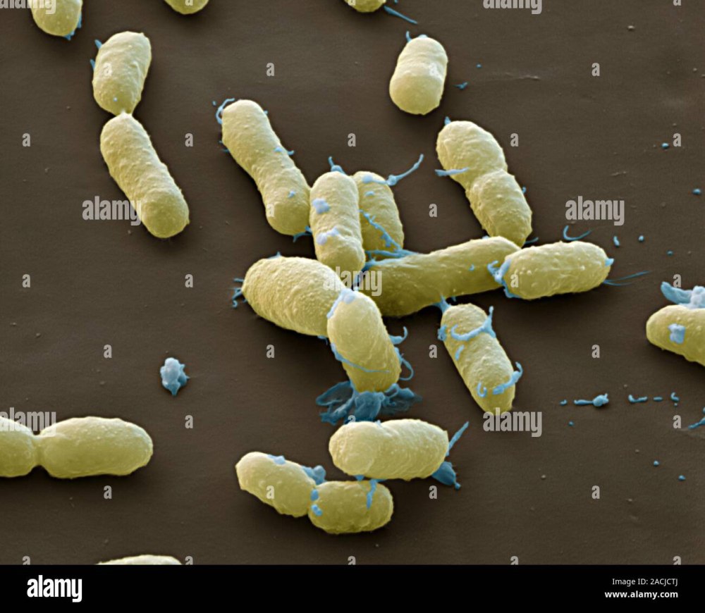 Инфицирующая доза Yersinia pestis