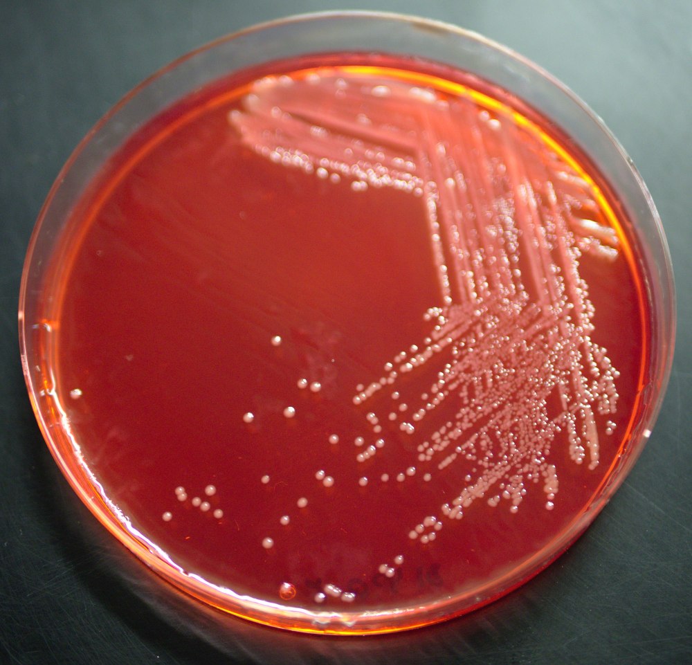 Yersinia enterocolitica