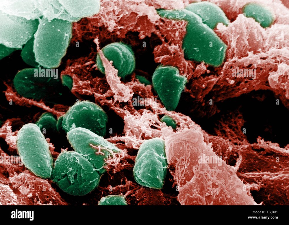 Чума возбудитель (Yersinia pestis)