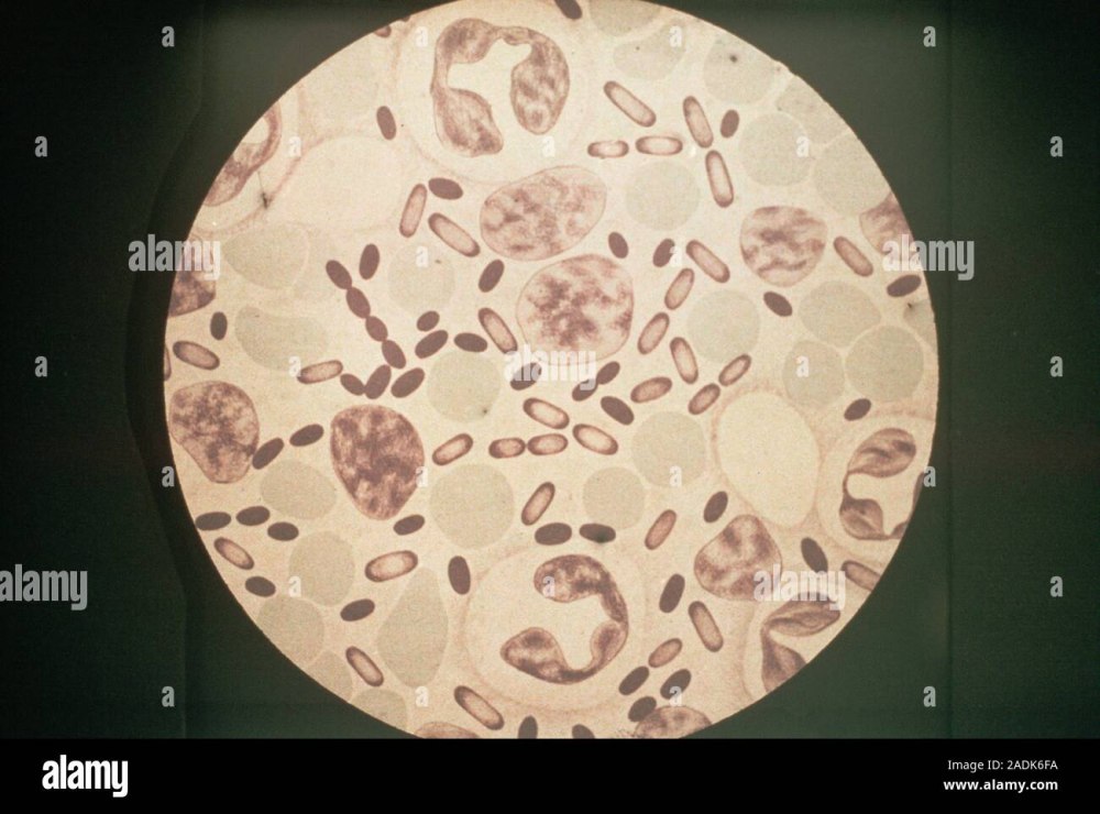 Yersinia pestis чумная палочка