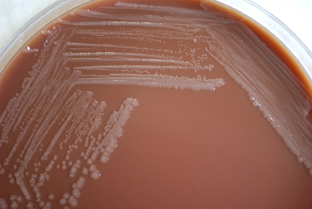Агар Туманского Yersinia pestis
