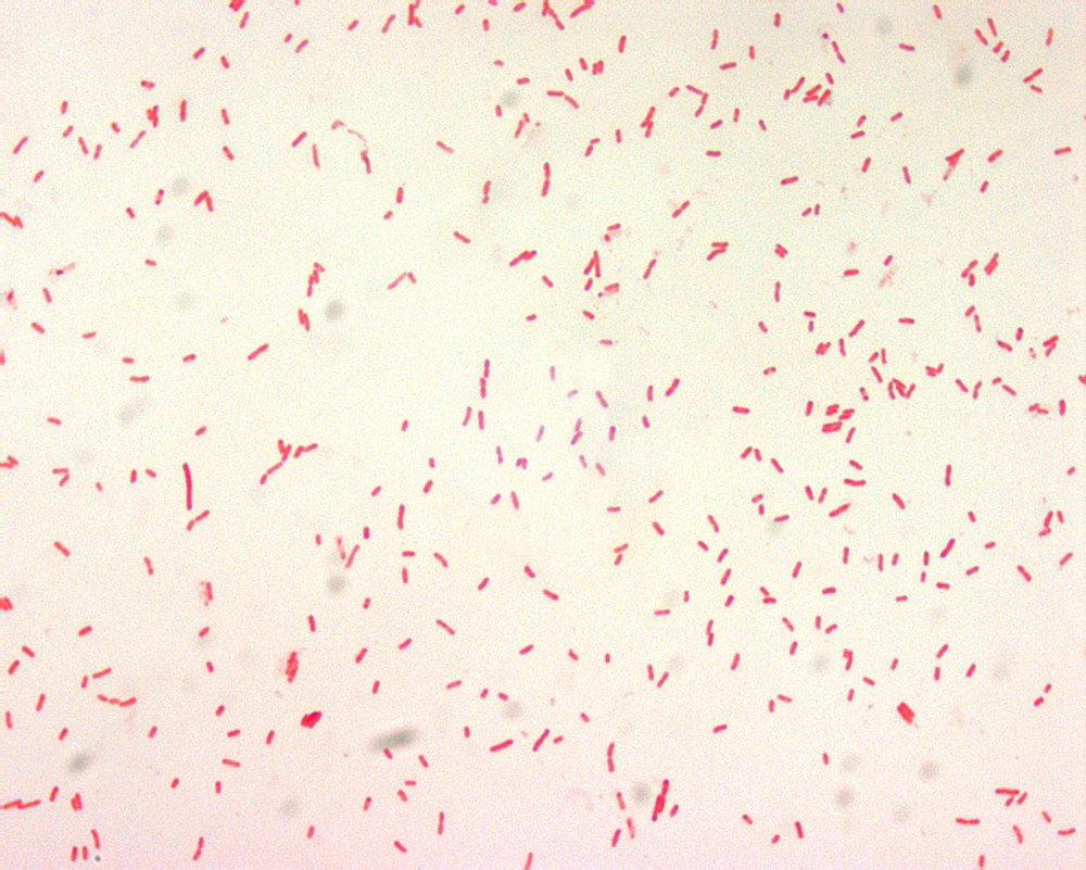 Yersinia pestis возбудитель чумы