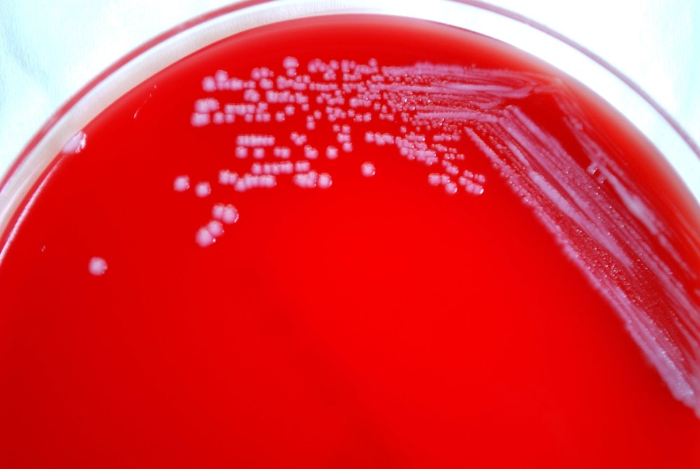 Yersinia pestis на чашке Петри