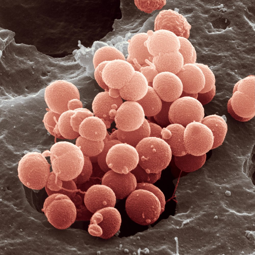 Менингококки Neisseria meningitidis