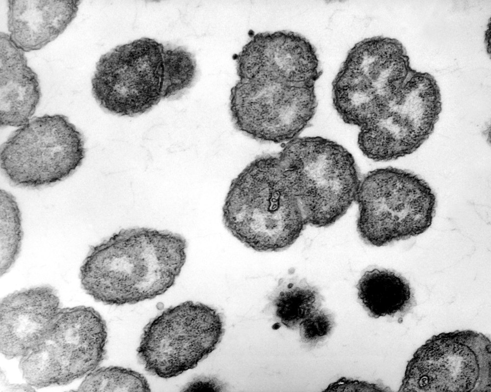 Neisseria gonorrhoeae микроскопия