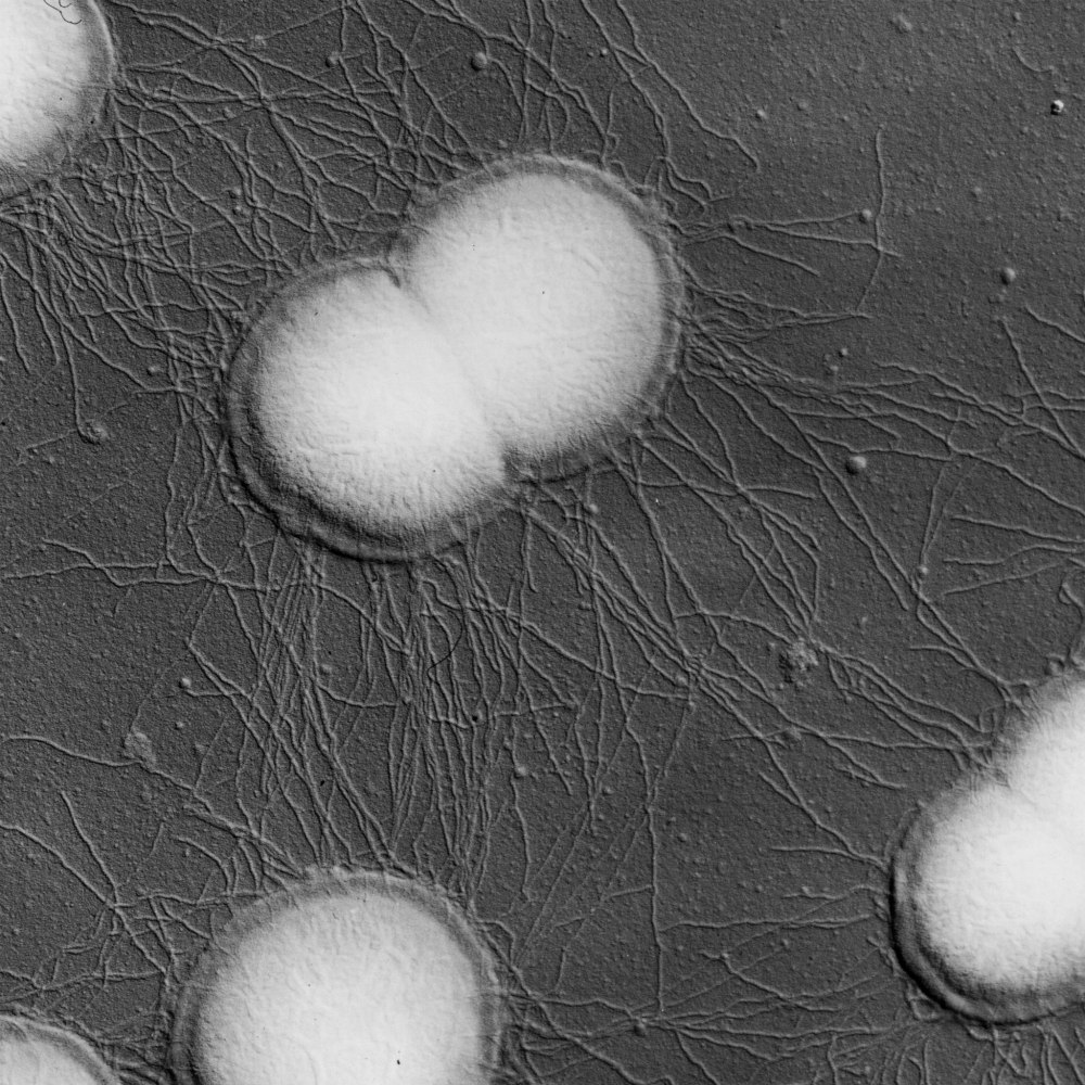 Возбудитель Neisseria gonorrhoeae