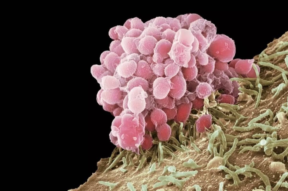Neisseria gonorrhoeae заболевания