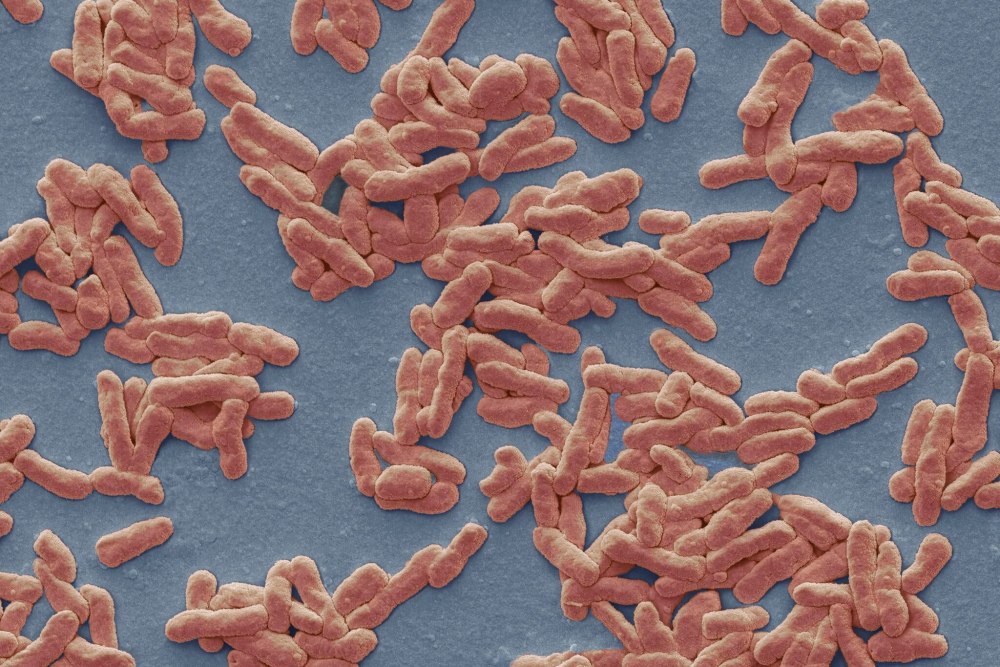 Лепра возбудитель Mycobacterium leprae