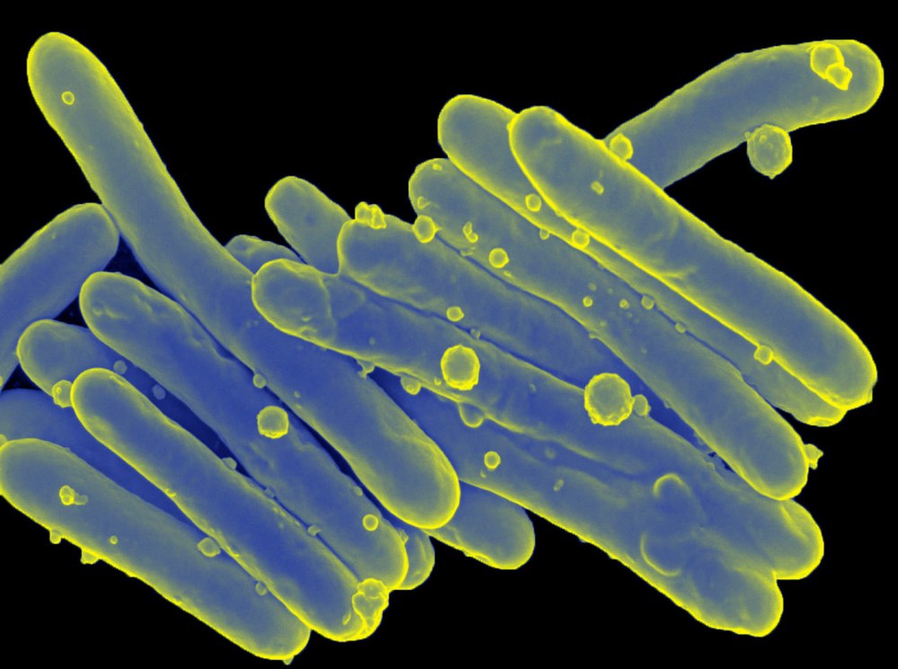 Палочка Коха (Mycobacterium tuberculosis)