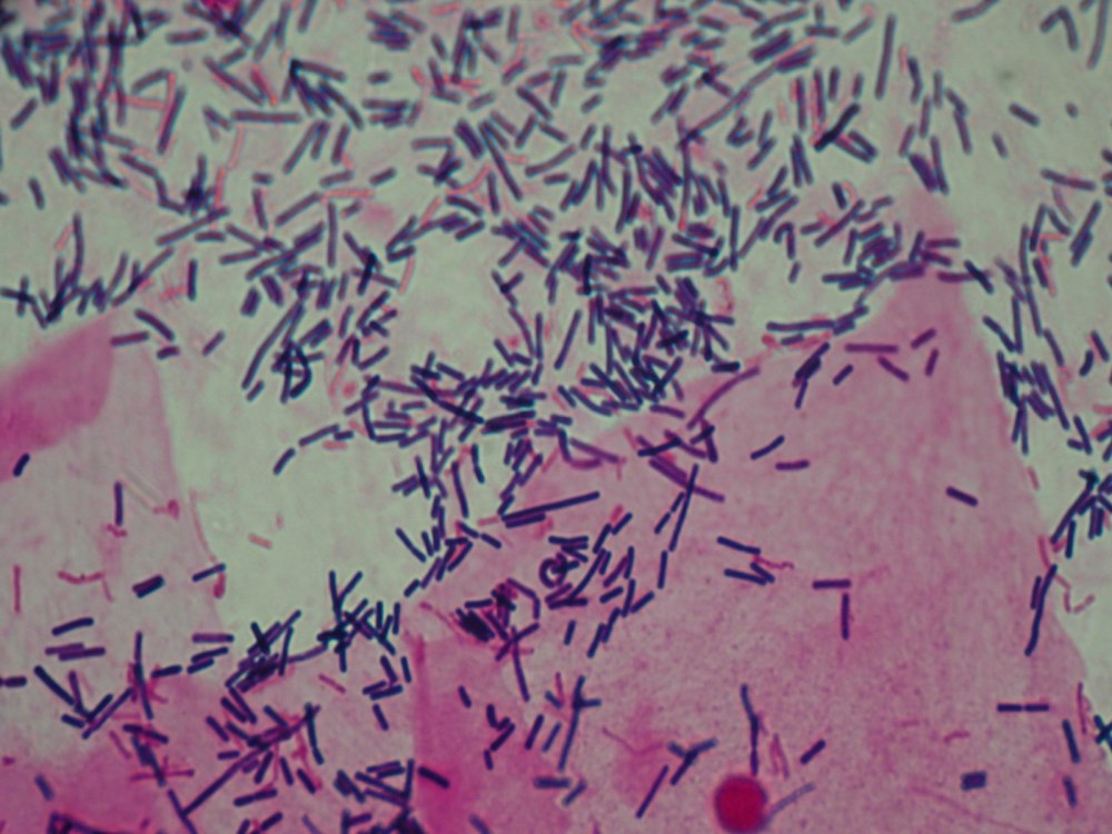 Lactobacillus Acidophilus грамотрицательные