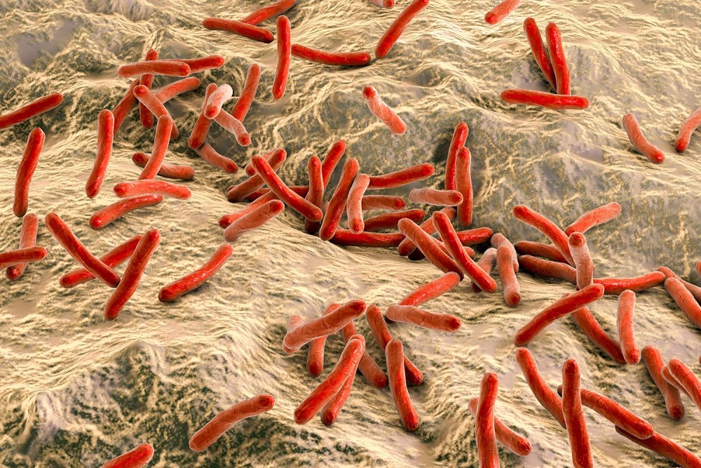 Лепра возбудитель Mycobacterium leprae