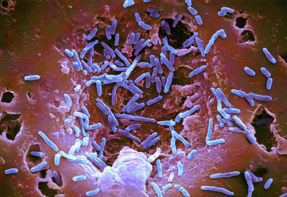 Mycobacterium Bovis микробиология