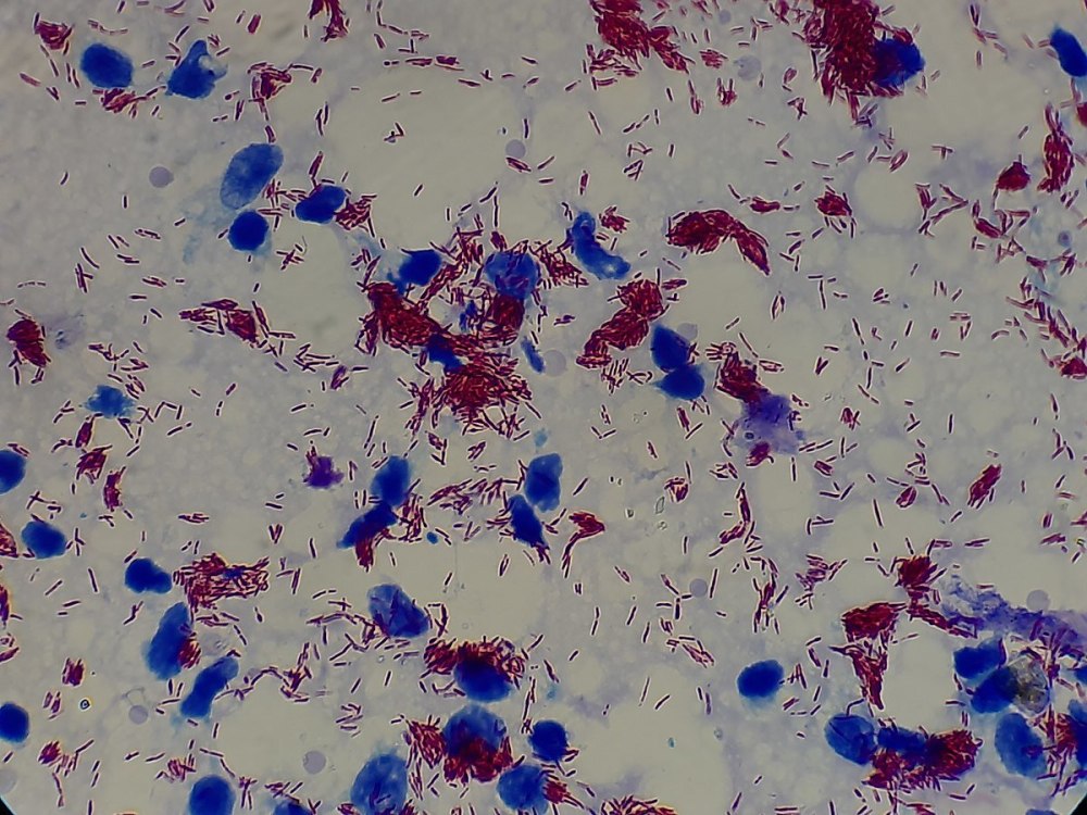 Mycobacterium leprae микроскопия