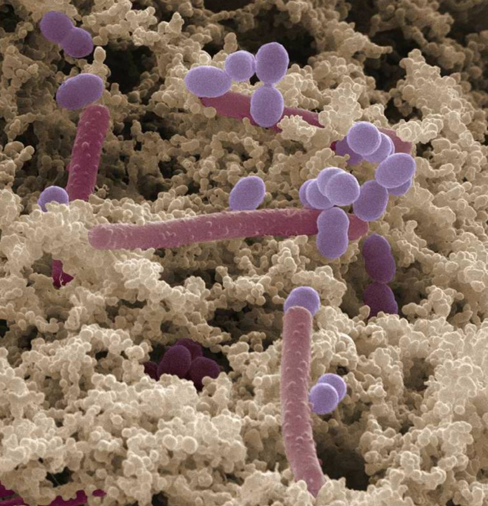 Болгарская палочка (Lactobacterium bulgaricum)