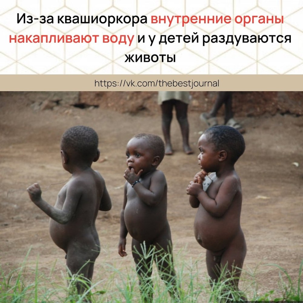Африканские дети мальчики