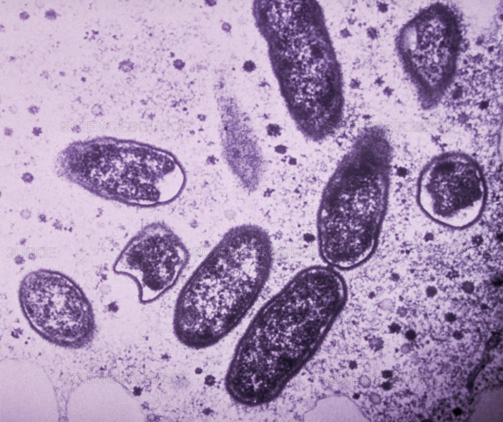 Rickettsia prowazekii возбудитель