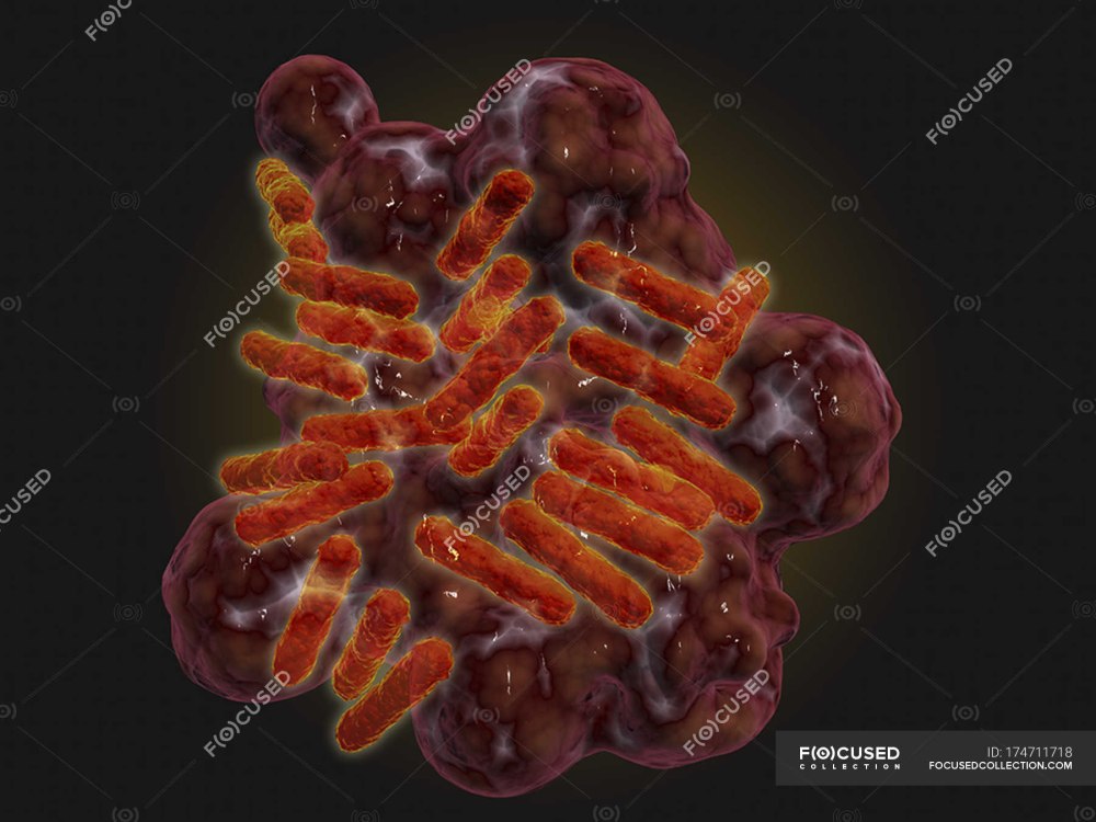 Rickettsia prowazekii возбудитель