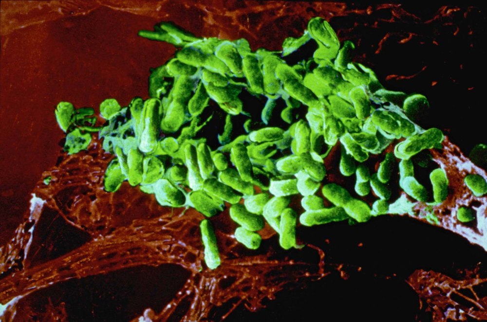 Rickettsia prowazekii возбудитель