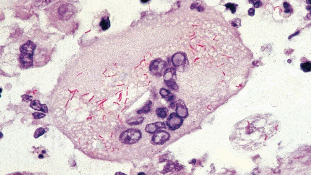 Rickettsia sibirica микробиология