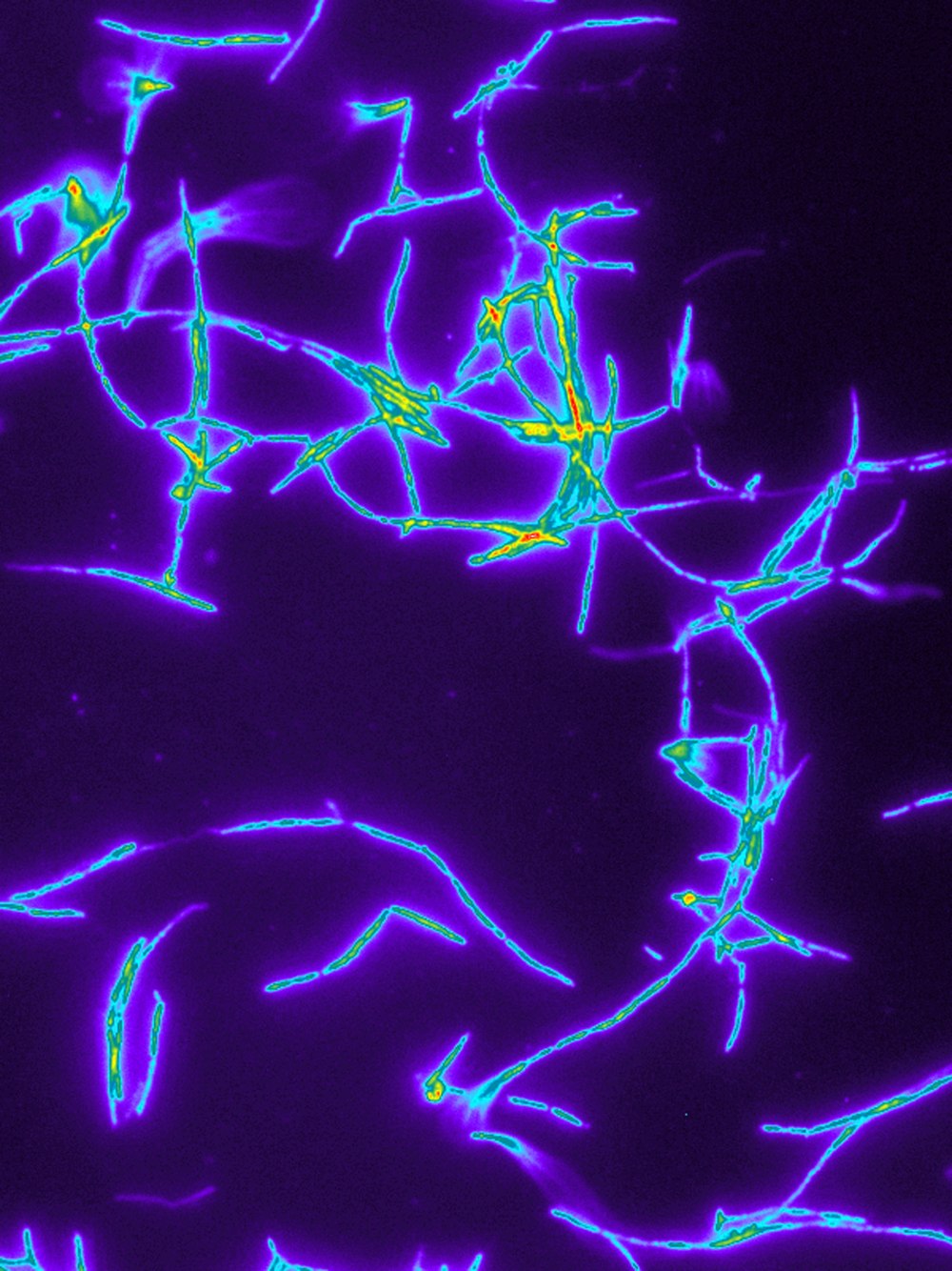 Streptomyces hygroscopicus