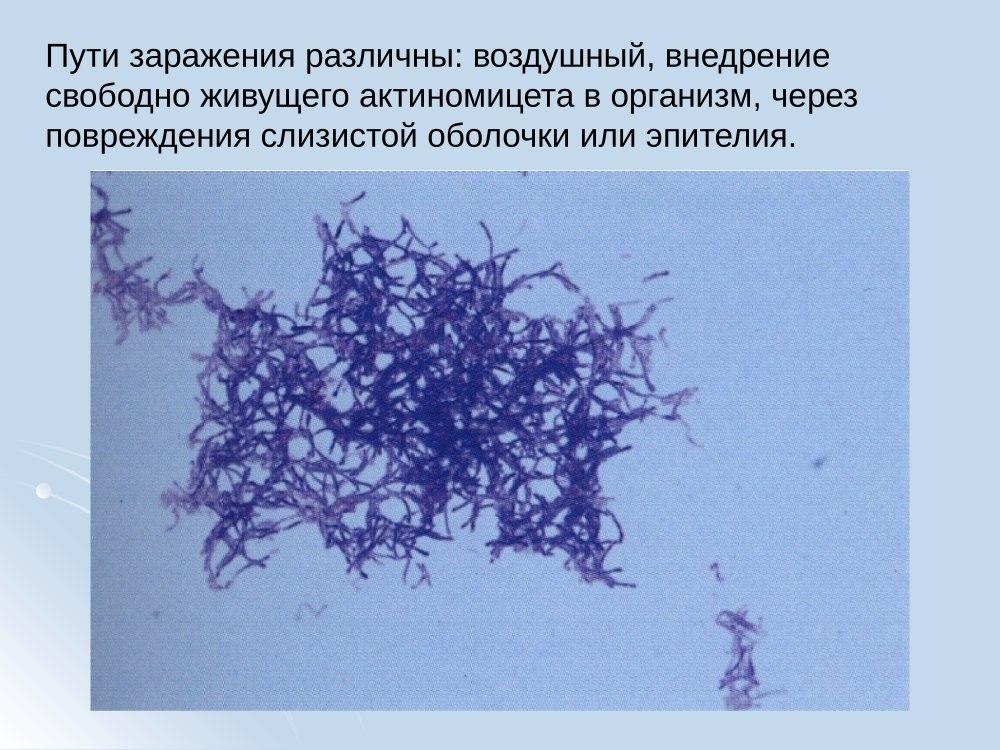 Нитчатые бактерии — актиномицеты
