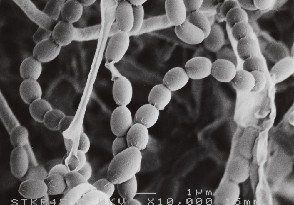 Streptomyces coelicolor
