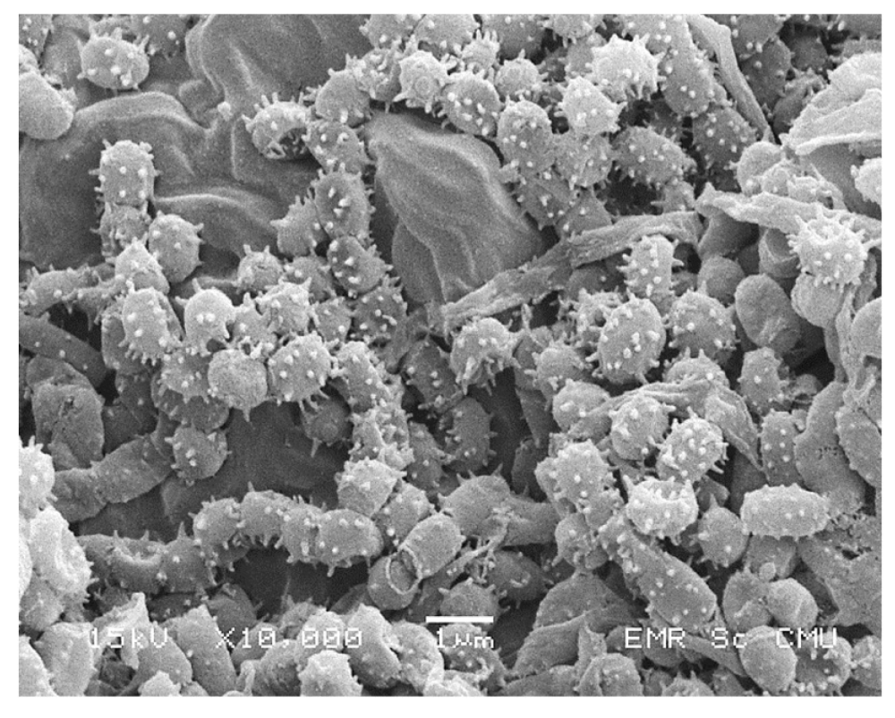 Streptomyces chromogenes под микроскопом