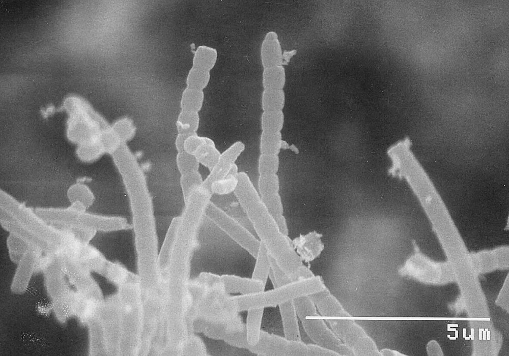 Streptomyces tsukubaensis