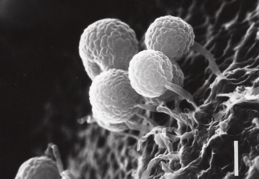 Streptomyces globisporus Streptomycini грибы