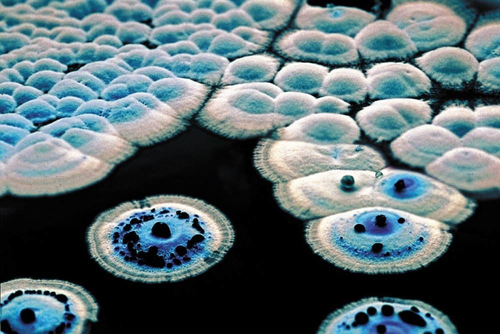 Streptomyces venezuelae