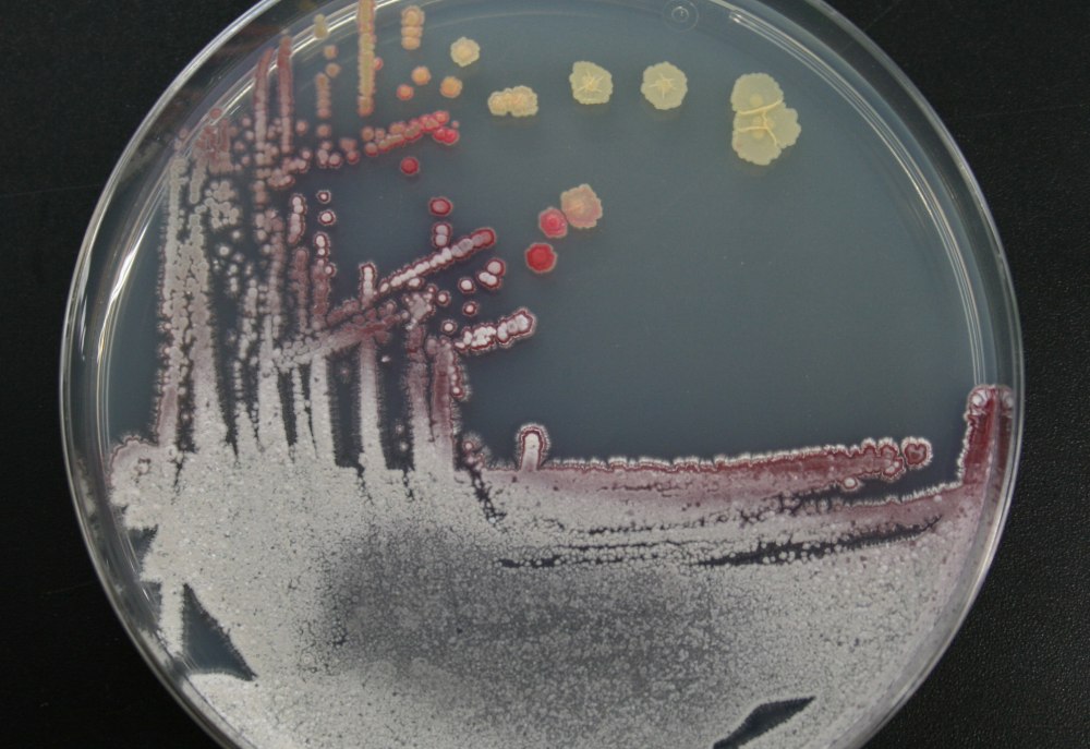 Бактерии стрептомицеты