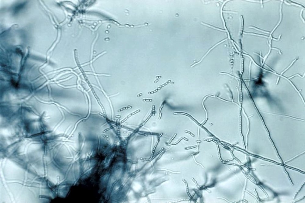Streptomyces venezuelae