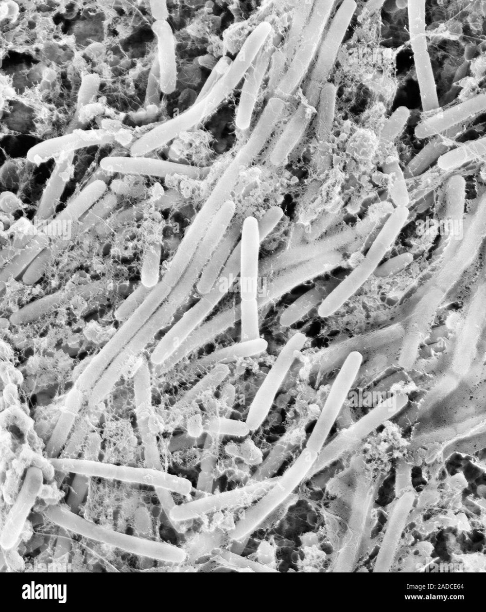 Actinomyces Bovis под микроскопом