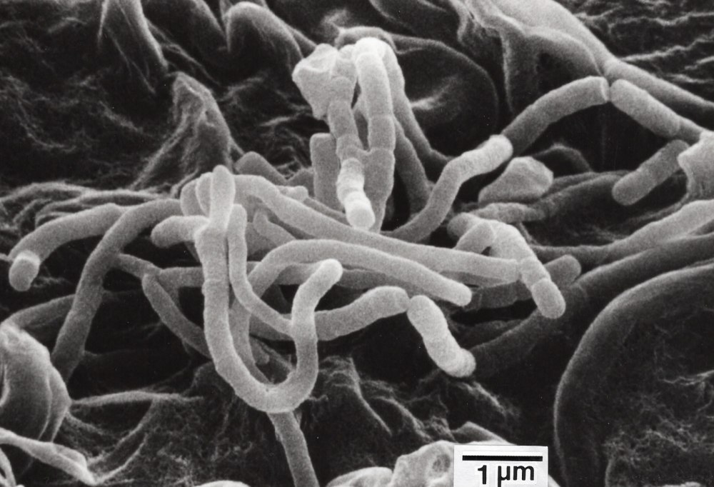 Streptomyces erythreus