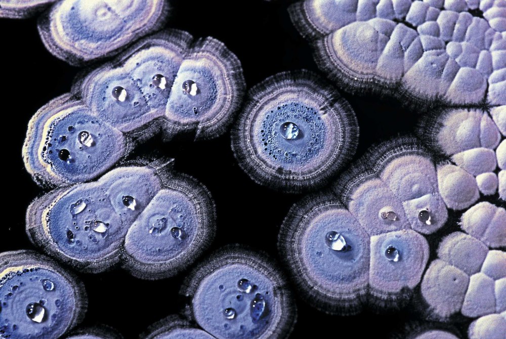 Streptomyces coelicolor