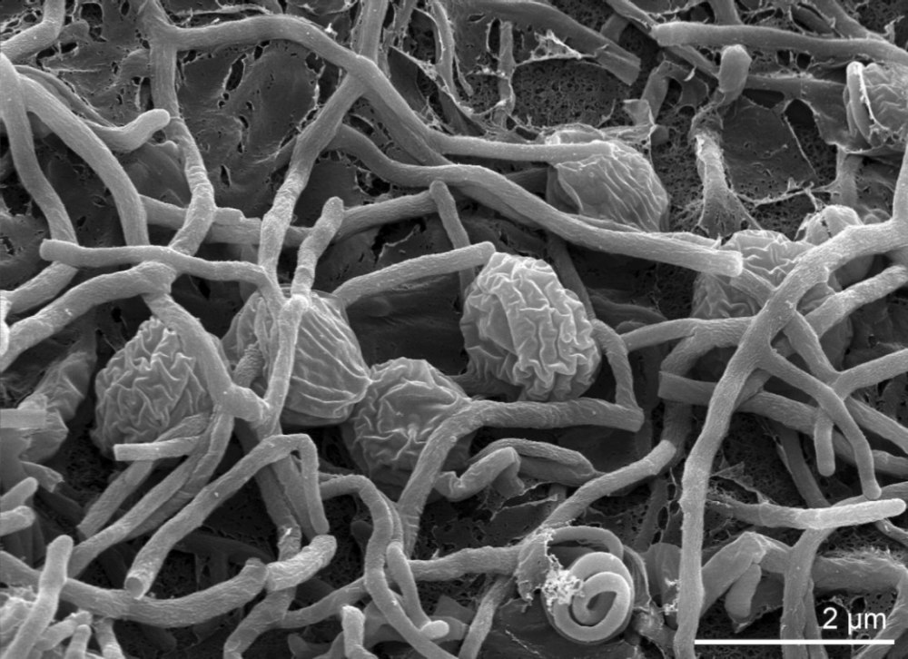 Streptomyces Scabies возбудитель