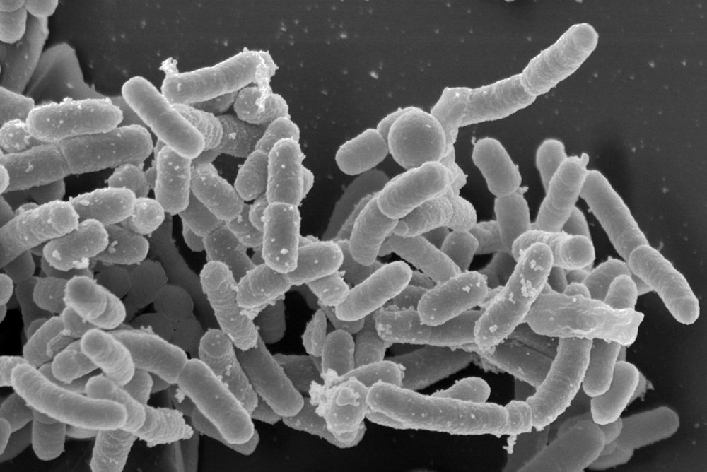 Возбудитель - иерсинии (Yersinia pestis)