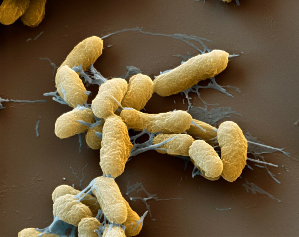 Yersinia pestis чумная палочка
