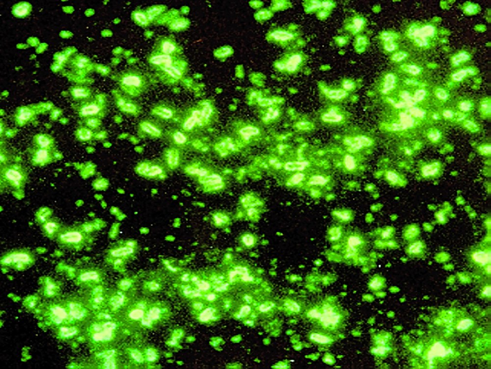 Yersinia pestis риф