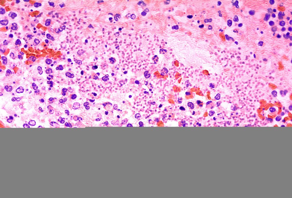 Yersinia pestis по Романовскому-Гимзе