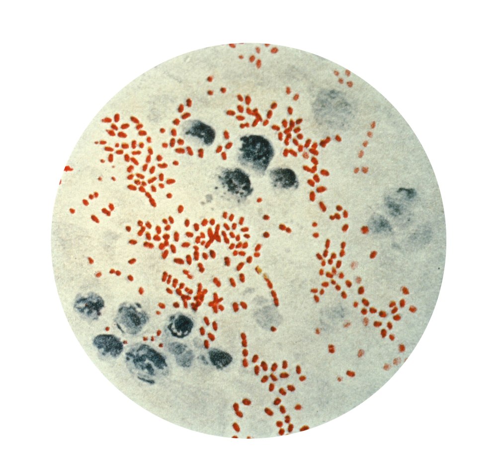 Чума возбудитель (Yersinia pestis)