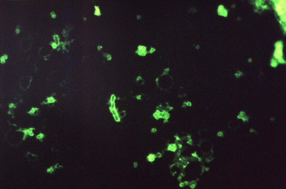 Yersinia pestis риф