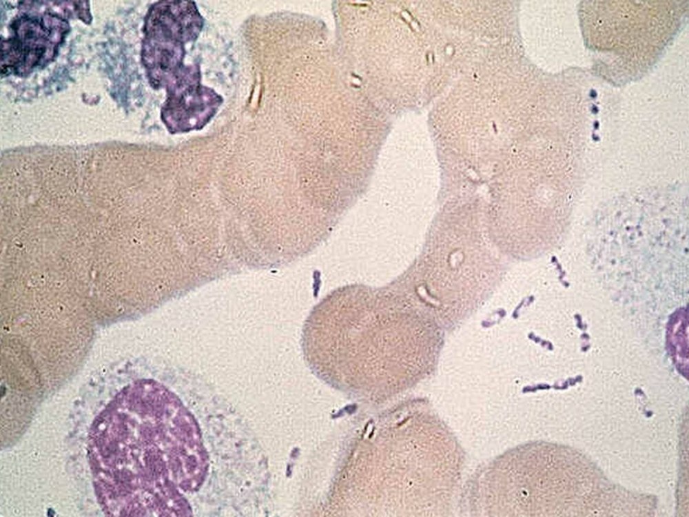 Чума возбудитель (Yersinia pestis)