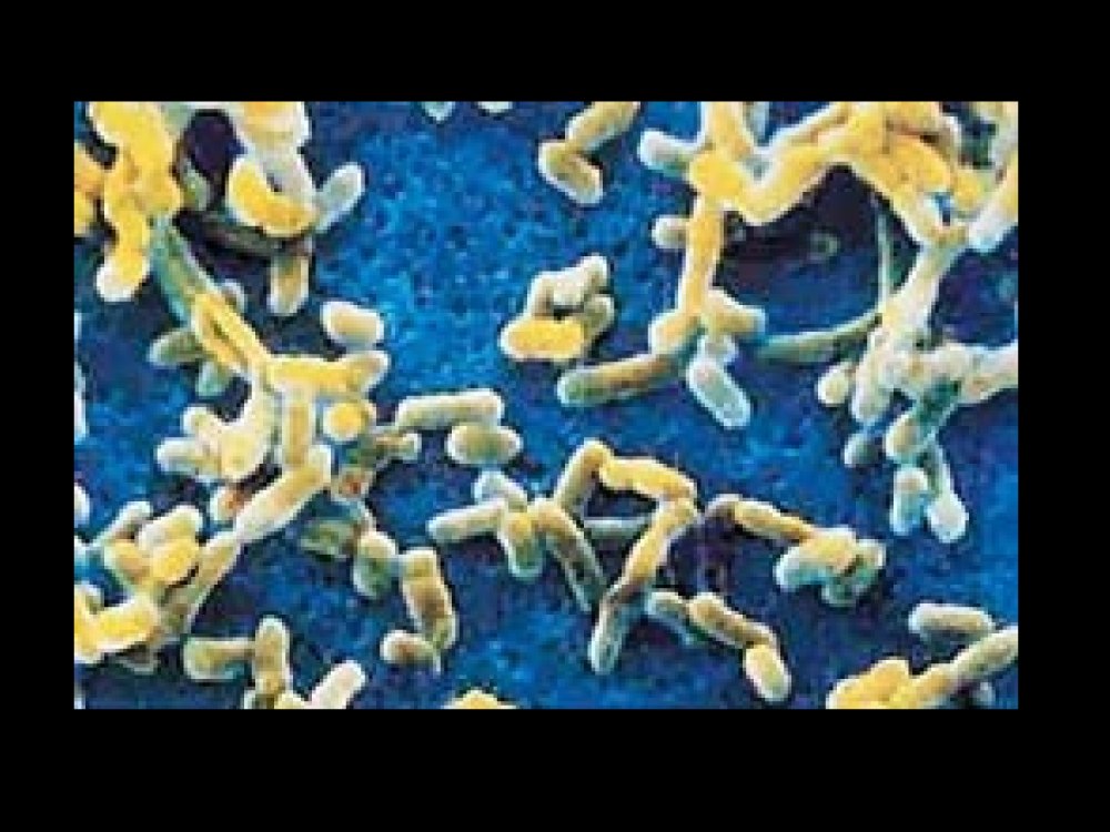 Возбудитель - бактерия y. pestis