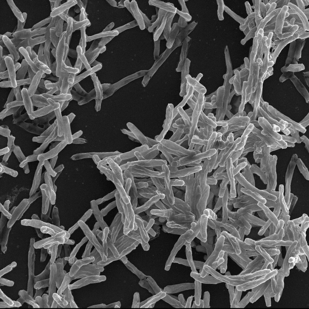 Палочка Коха (Mycobacterium tuberculosis)