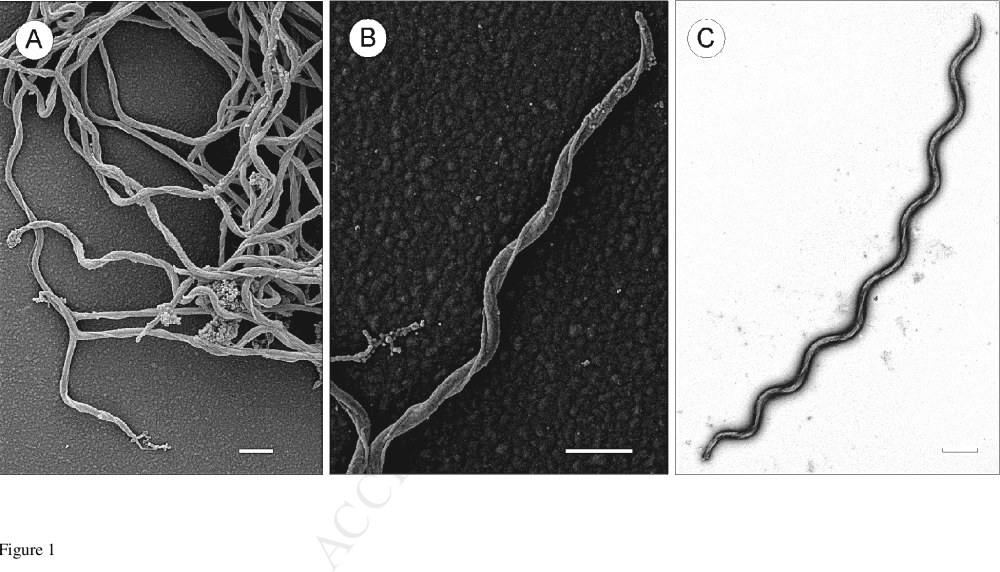 Днк borrelia burgdorferi. Спирохеты боррелии. Спирохета боррелия бургдорфери. Borrelia recurrentis (спирохета Обермейера). Borrelia burgdorferi микробиология.