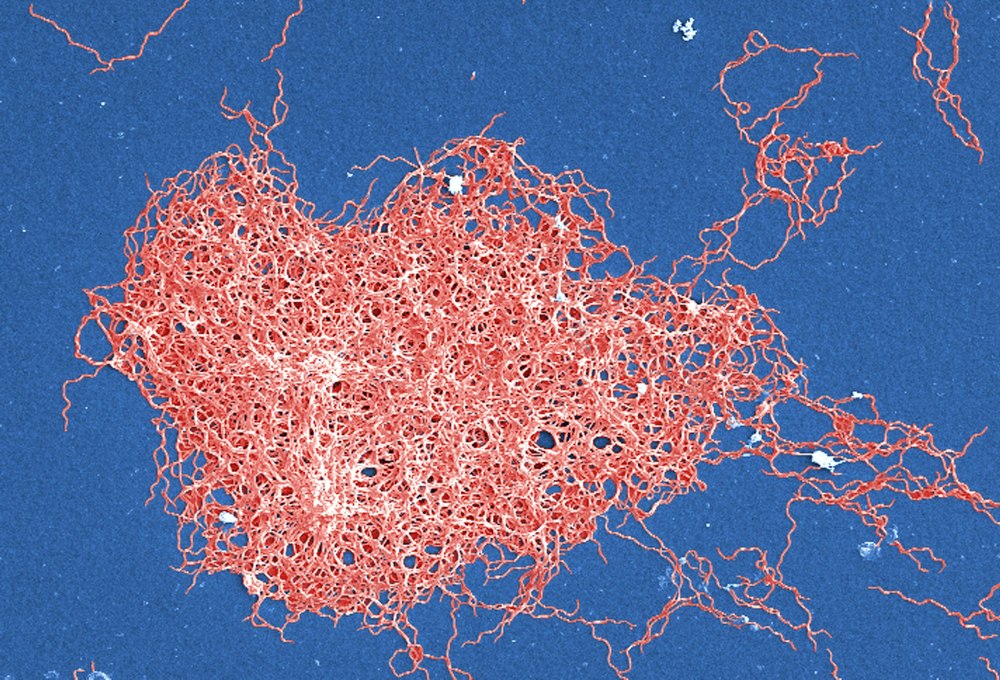 B burgdorferi под микроскопом