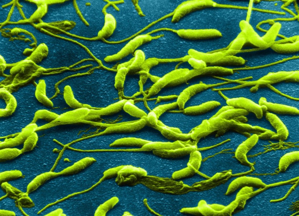 Caulobacter crescentus
