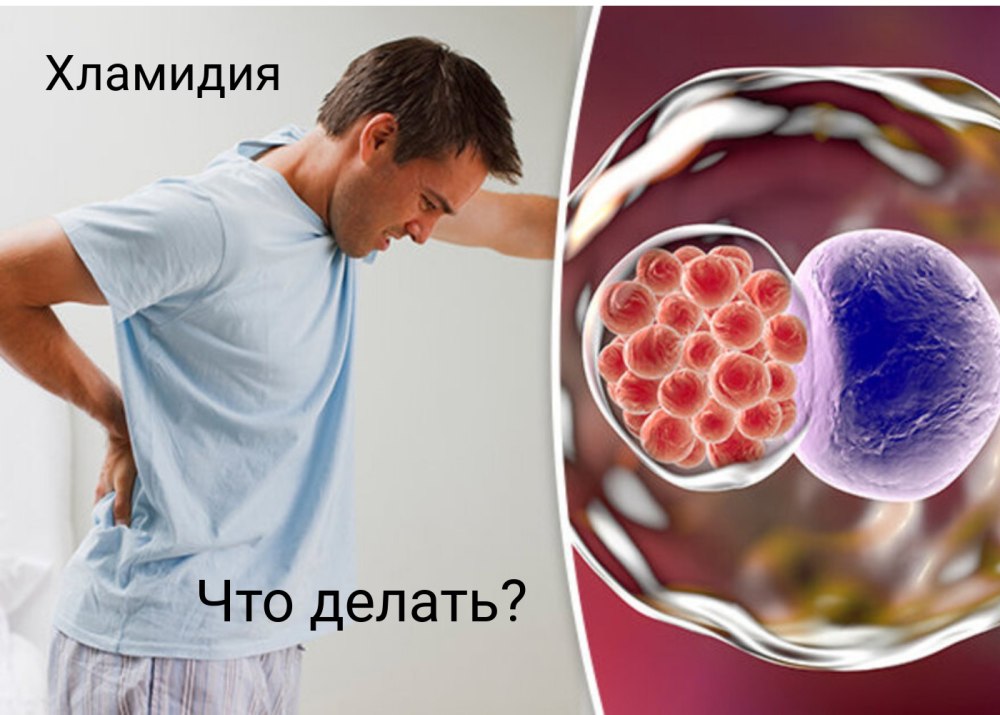 Урогенитальный хламидиоз у мужчин
